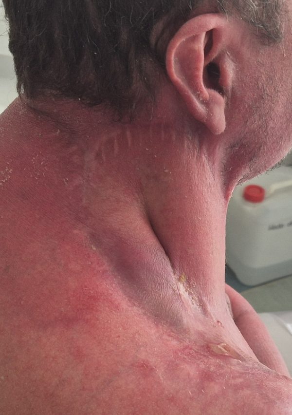 Otolaryngologia rekonstrukcja (4)