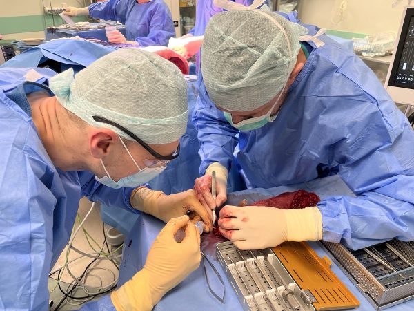 Otolaryngologia rekonstrukcja (6)